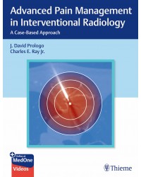 Advanced Pain Management in Interventional Radiology